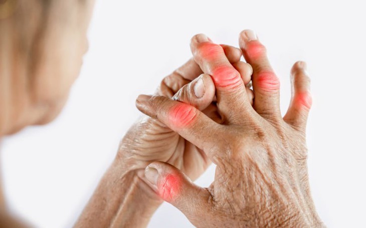 6 giải pháp ngăn ngừa viêm khớp dạng thấp tái phát khi chuyển mùa