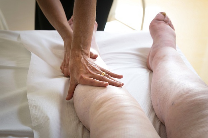 Phù là tình trạng sưng do lượng dịch bên trong cơ thể bị dư thừa và mắc kẹt giữa các mô.