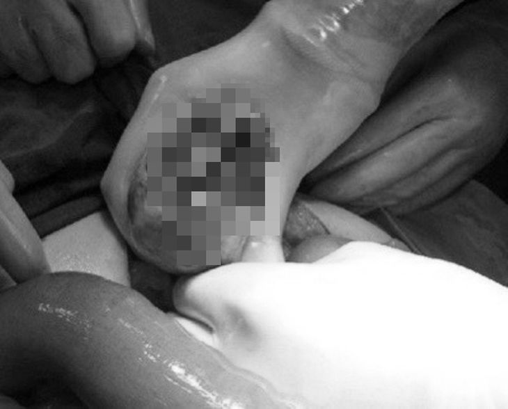 Cảnh báo những thực phẩm dễ gây tắc ruột nhất ai cũng nên biết để phòng tránh - Ảnh 3.