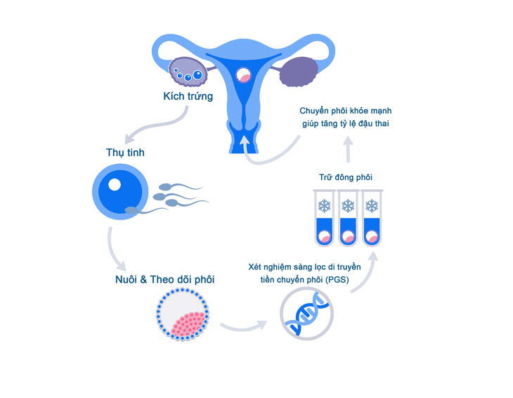 Tăng tỷ lệ thành công IVF nhờ kỹ thuật sàng lọc phôi tiền làm tổ - Ảnh 1.