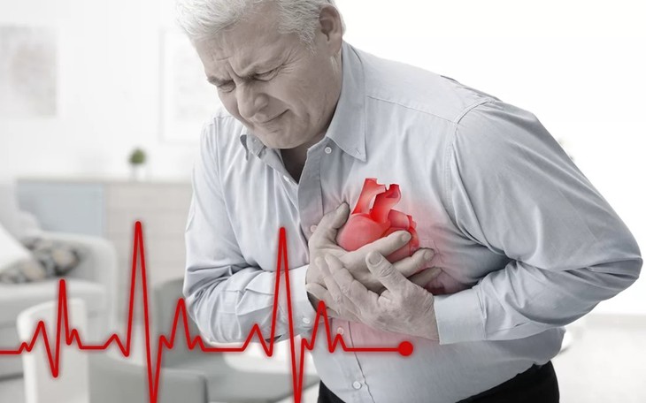 Phòng ngừa đột quỵ đối với những người có nguy cơ cao - Ảnh 1.