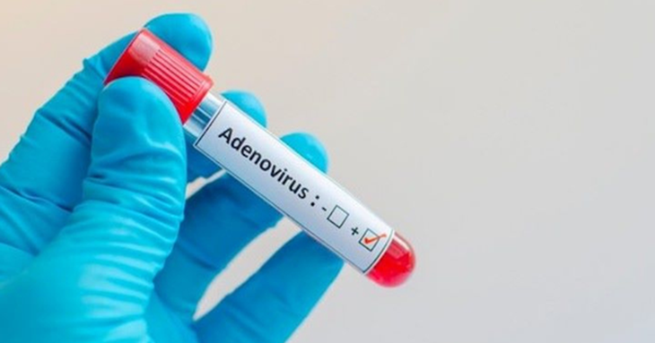 Khi nào nên xét nghiệm Adenovirus cho trẻ? - Ảnh 1. Khi nào nên xét nghiệm Adenovirus cho trẻ? - Ảnh 1.