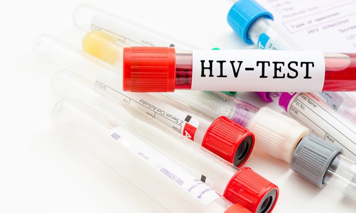 Bác sĩ  lý giải nguy cơ lây nhiễm HIV ở bệnh nhân nghiện ma tuý?   - Ảnh 2.
