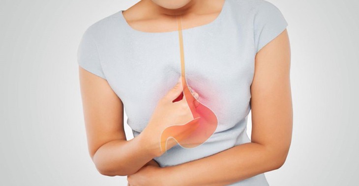 Nên điều trị trào ngược dạ dày thực quản vào thời điểm nào? - Ảnh 1.