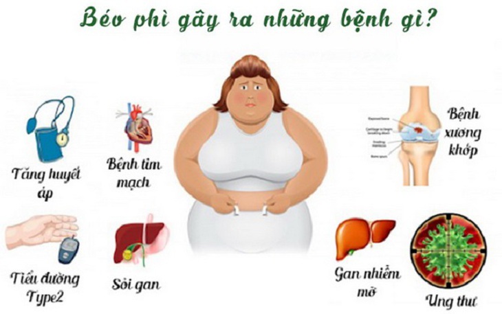 Chẩn đoán béo phì theo chỉ số BMI và điều trị bệnh béo phì