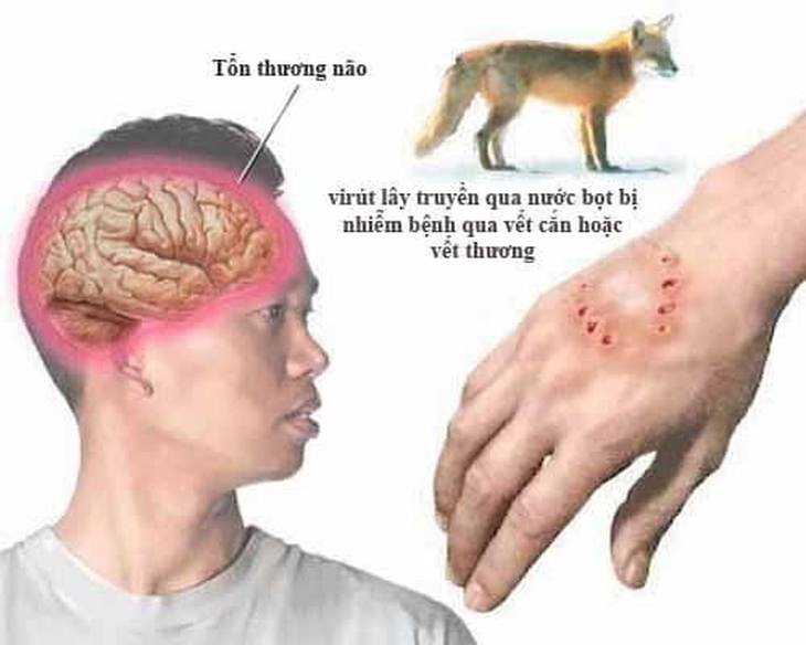 Nghệ An: Xử lý nghiêm cơ sở, cá nhân tuyên truyền, sử dụng thuốc Nam để điều trị bệnh dại - Ảnh 1.