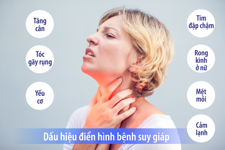 Nguyên nhân gây hội chứng suy giáp - Ảnh 2.