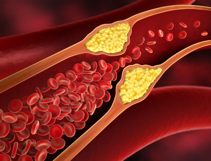 Phát triển thuốc mới giảm cholesterol - Ảnh 2.