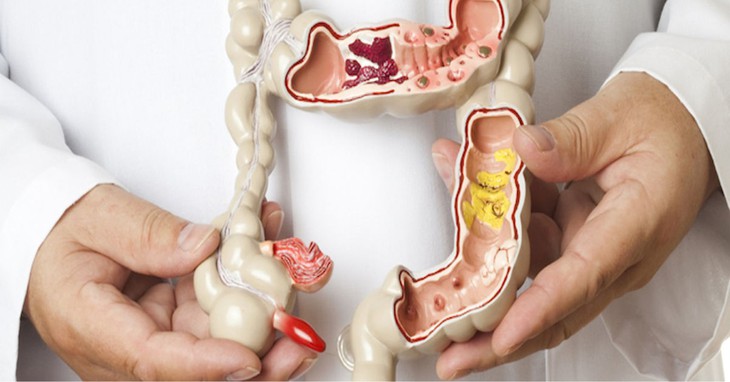 Lần đầu tiên trên thế giới phê duyệt liệu pháp cấy ghép phân - Ảnh 1.