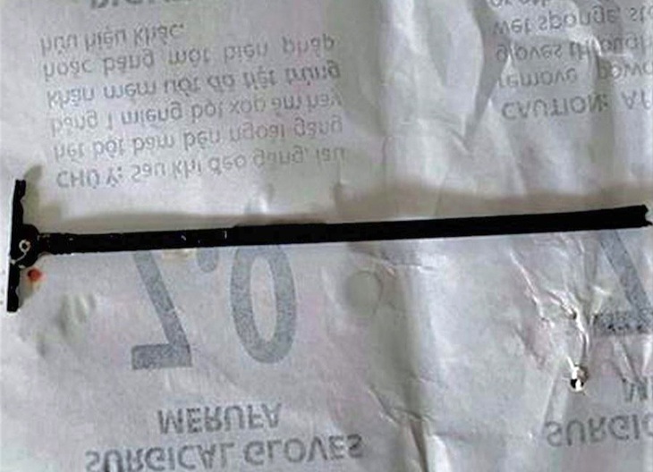 Cứu sống bệnh nhi 4 tuổi bị thanh thép đâm xuyên miệng - Ảnh 1.