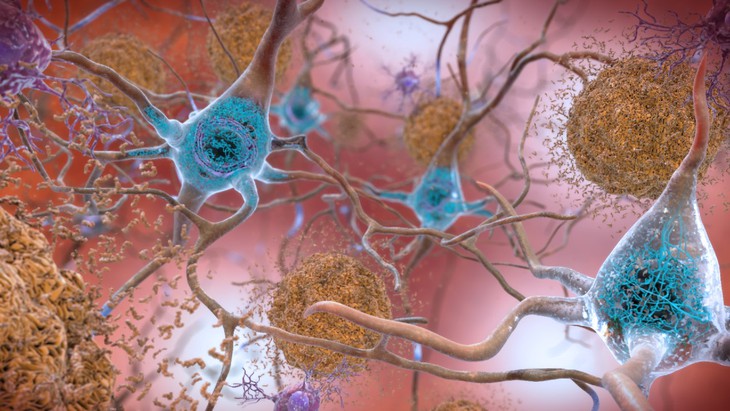Hợp chất trong trà xanh và rượu vang làm chậm sự tiến triển của bệnh Alzheimer - Ảnh 1.