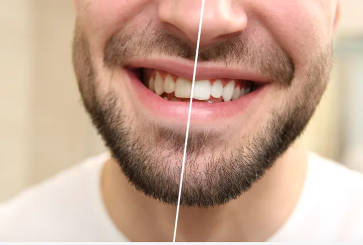 Sự thay đổi của cơ thể sau 1 tháng ngừng uống cà phê - Ảnh 3.
