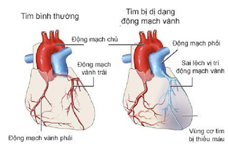 Tim đập nhanh, mệt, thở khó...cảnh giác với bệnh trọng cần nhập viện ngay - Ảnh 1.