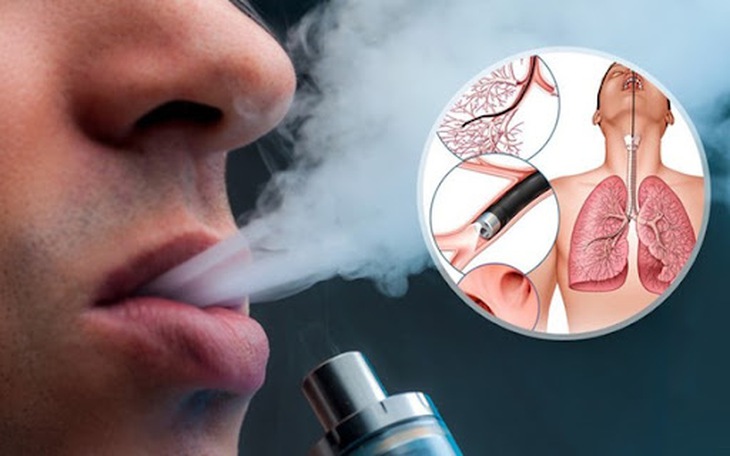 Bé trai 5 tuổi suýt mất mạng vì ngộ độc ma tuý tổng hợp 'nguỵ trang' trong thuốc lá điện tử - Ảnh 1. Bé trai 5 tuổi suýt mất mạng vì ngộ độc ma tuý tổng hợp 'nguỵ trang' trong thuốc lá điện tử - Ảnh 1.