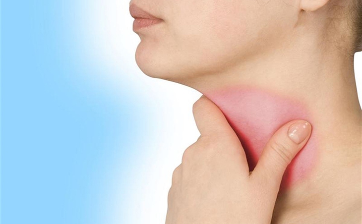 Biểu hiện tổn thương khi mắc Basedow - Ảnh 2.