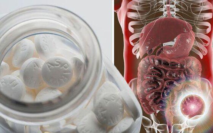 4 cảnh báo chỉ ra aspirin không an toàn cho tất cả mọi người