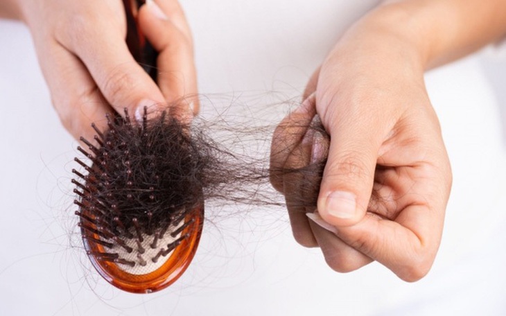 Nỗi lo rụng tóc khi mùa đông đến gần