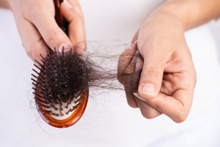 Nỗi lo rụng tóc khi mùa đông đến gần - Ảnh 2.