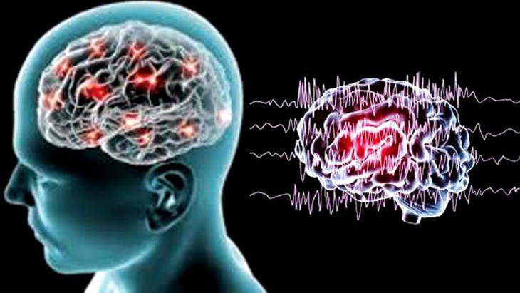 Khám phá thuốc mới điều trị bệnh động kinh - Ảnh 1. Khám phá thuốc mới điều trị bệnh động kinh - Ảnh 1.