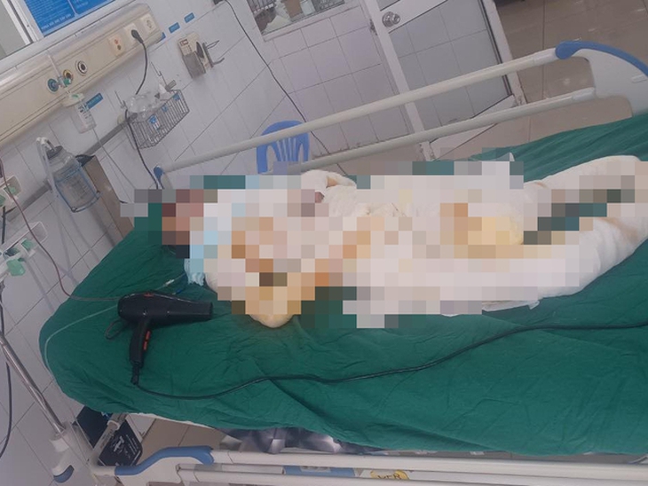 Vụ con đốt nhà mẹ: Sau nhiều lần phẫu thuật ghép da, người mẹ vẫn yếu không thể nói chuyện - Ảnh 1.