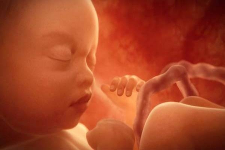 Khi nào mẹ bầu nên thực hiện siêu âm 4D? - Ảnh 2.