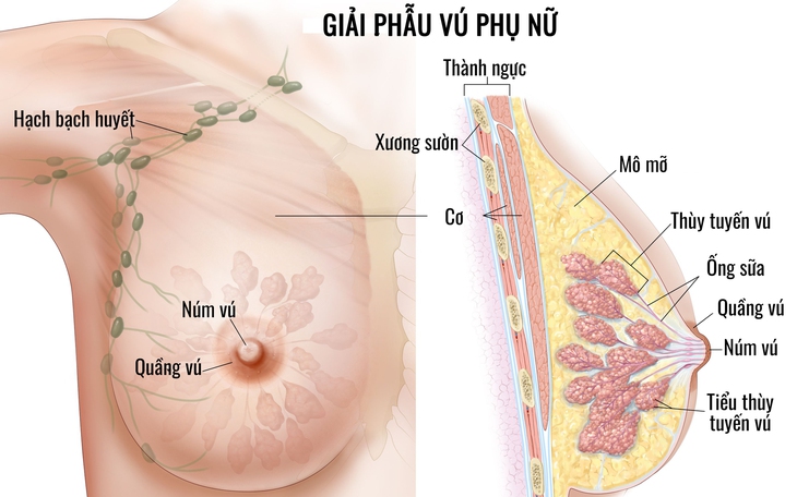 Ung thư vú: Các dấu hiệu nhận biết sớm