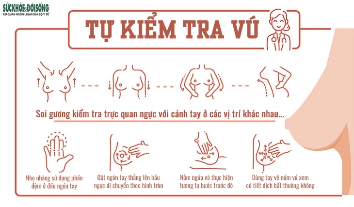 Ung thư vú: Các dấu hiệu nhận biết sớm - Ảnh 3.
