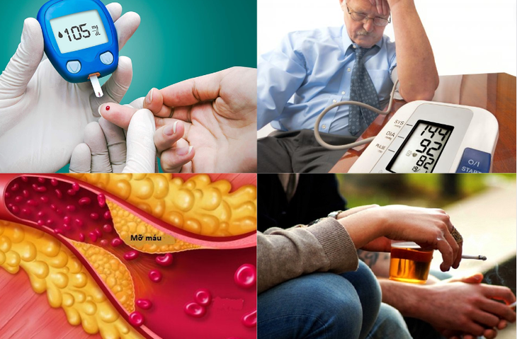 Ai cũng có nguy cơ đột quỵ não: Chớ chủ quan! - Ảnh 1.
