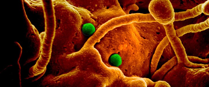 'Cúm lạc đà' - Hội chứng hô hấp Trung Đông coronavirus (MERS-CoV), phòng ngừa thế nào? - Ảnh 3. 'Cúm lạc đà' - Hội chứng hô hấp Trung Đông coronavirus (MERS-CoV), phòng ngừa thế nào? - Ảnh 3.