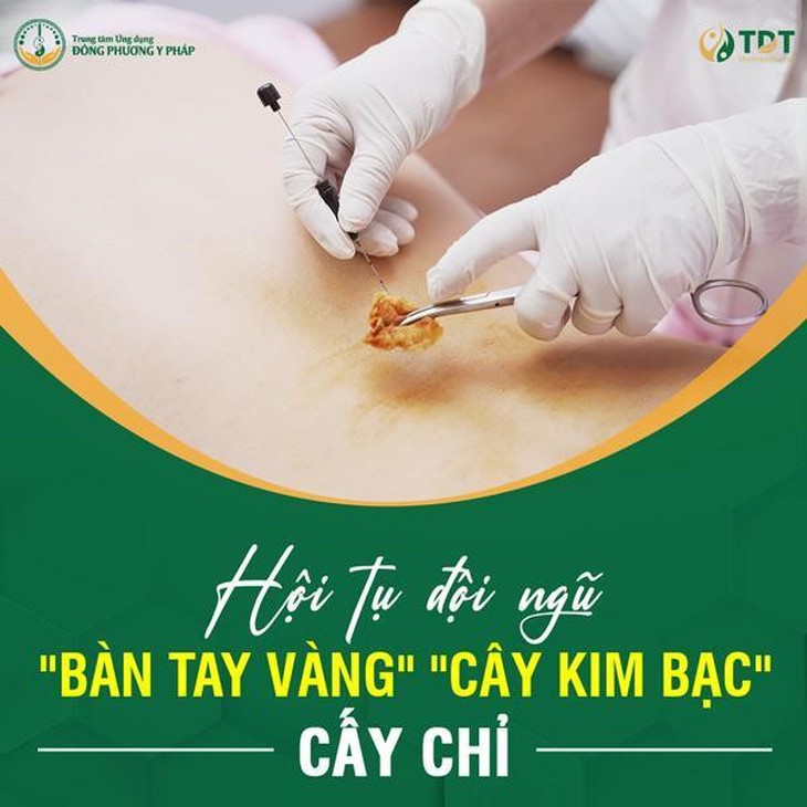 Địa chỉ cấy chỉ chữa bệnh uy tín, chất lượng hiện nay - Ảnh 1.