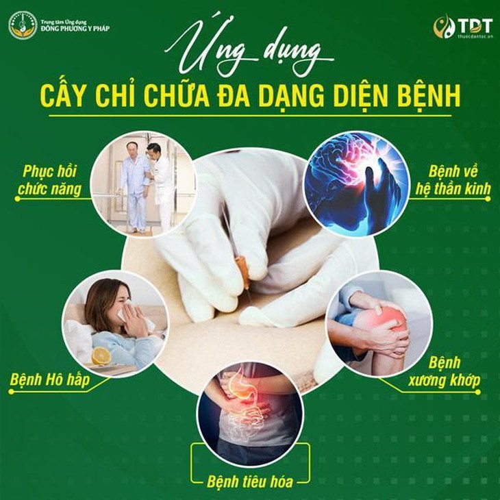 Địa chỉ cấy chỉ chữa bệnh uy tín, chất lượng hiện nay - Ảnh 2.