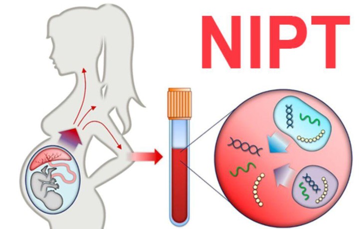 Phụ nữ mang thai xét nghiệm NIPT ở đâu uy tín tại Hà Nội? - Ảnh 2. Phụ nữ mang thai xét nghiệm NIPT ở đâu uy tín tại Hà Nội? - Ảnh 2.