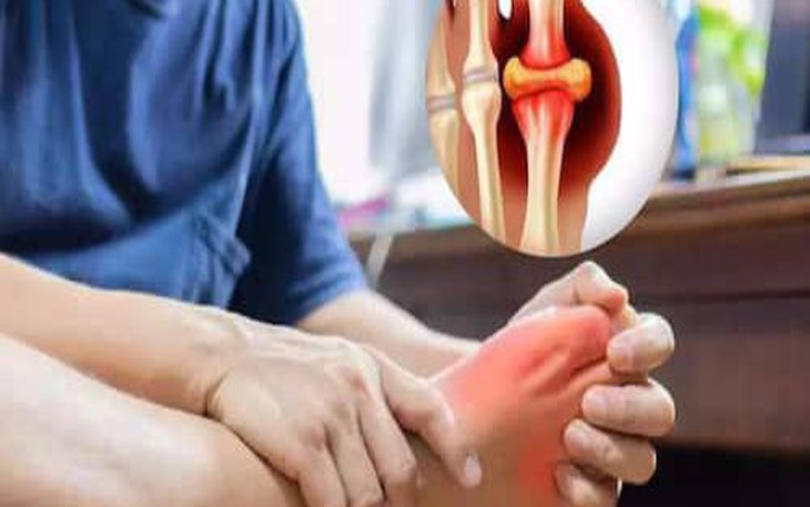 Tăng axit uric trong mùa đông, cách nào giúp giảm đau khớp?