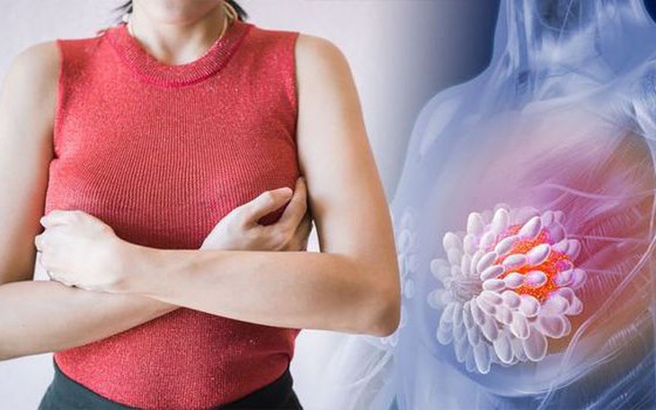 Phát hiện u vú lành tính bỏ mặc hay đi tầm soát ung thư?