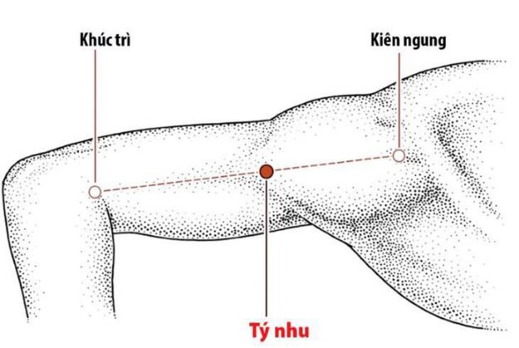 photo-1671767602930