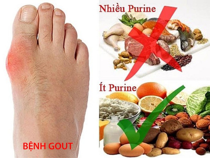 Dinh dưỡng cho người mắc bệnh gout trong dịp Tết - Ảnh 3.