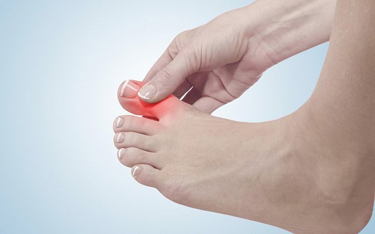 9 thực phẩm người bệnh gout nên đưa vào thực đơn hàng ngày