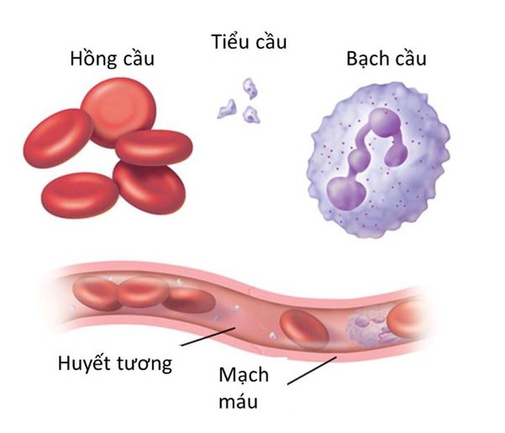 Tổn thương hệ tạo máu ở người bệnh lupus ban đỏ hệ thống - Ảnh 1. Tổn thương hệ tạo máu ở người bệnh lupus ban đỏ hệ thống - Ảnh 1.