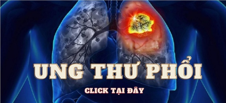 Điều trị ung thư phổi không tế bào nhỏ bằng liệu pháp miễn dịch - Ảnh 1. Điều trị ung thư phổi không tế bào nhỏ bằng liệu pháp miễn dịch - Ảnh 1.