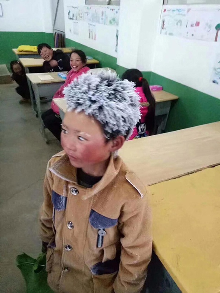 Cậu bé "người tuyết" từng làm hàng triệu trái tim thổn thức giờ ra sao sau 4 năm đầy biến động? - Ảnh 2.