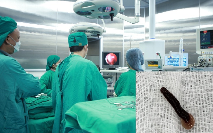 Đi làm đồi, uống nước suối bị đỉa chui vào mũi gây khó thở, chảy máu