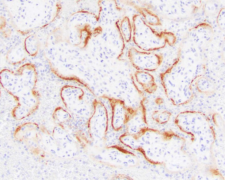 Coronavirus có thể phá hủy nhau thai và dẫn đến thai chết lưu - Ảnh 1.