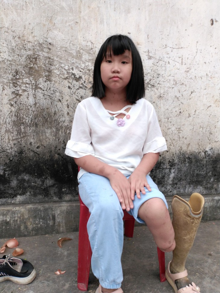 MS 733: Thương cảm người phụ nữ gồng gánh chồng bệnh thần kinh, con mất sớm com lại bị cụt một chân - Ảnh 1. MS 733: Thương cảm người phụ nữ gồng gánh chồng bệnh thần kinh, con mất sớm com lại bị cụt một chân - Ảnh 1.