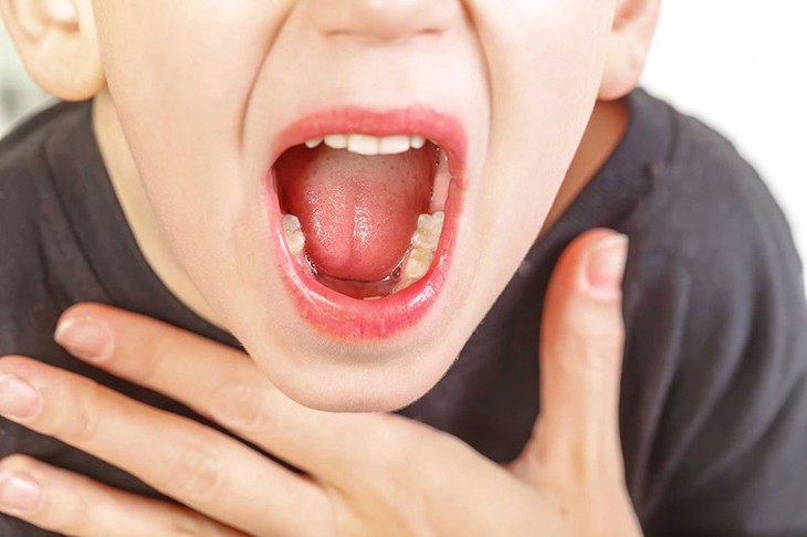 Những bệnh ''thích'' trời lạnh và cách phòng bệnh - Ảnh 1.