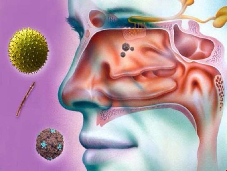 Những bệnh ''thích'' trời lạnh và cách phòng bệnh - Ảnh 3.