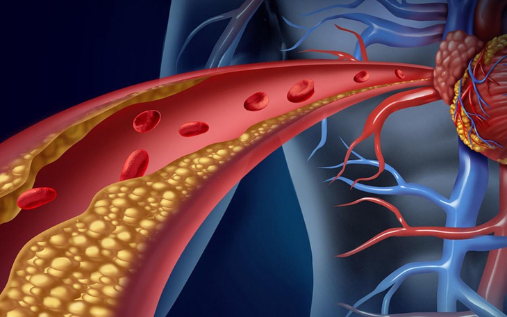 9 thực phẩm kiểm soát cholesterol và giảm nguy cơ mắc bệnh tim