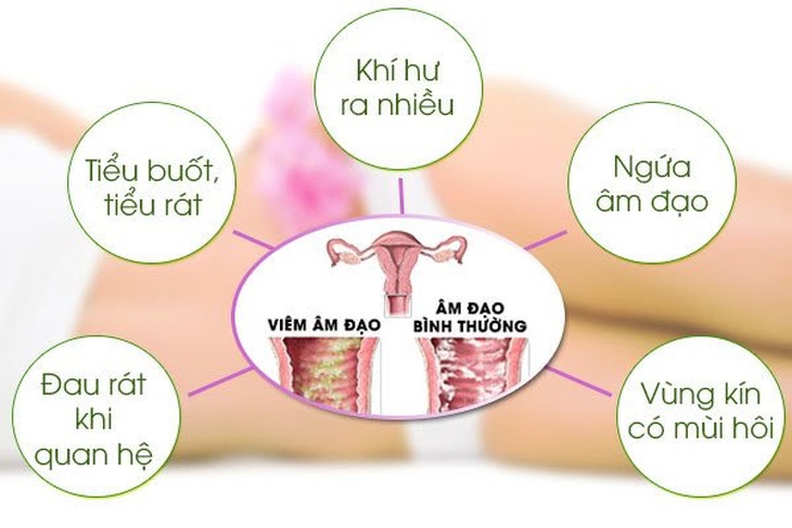 Viêm âm đạo do vi khuẩn: Nguy cơ, biến chứng và cách phòng ngừa - Ảnh 3. Viêm âm đạo do vi khuẩn: Nguy cơ, biến chứng và cách phòng ngừa - Ảnh 3.