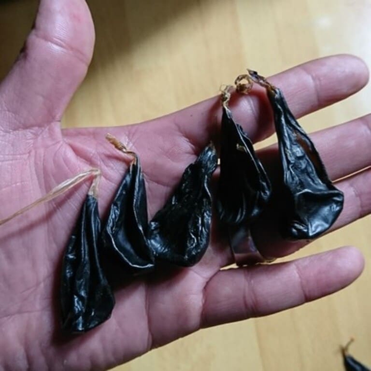Cháu bé 9 ngày tuổi nguy kịch vì người nhà cho dùng mật khỉ - Ảnh 1. Cháu bé 9 ngày tuổi nguy kịch vì người nhà cho dùng mật khỉ - Ảnh 1.