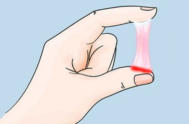 Sự tiết dịch âm đạo là một tín hiệu rất quan trọng để biết mức độ lành mạnh của âm đạo. Thế nhưng cũng có lúc dịch âm đạo "bị bệnh" mà chủ nhân không hoặc biết muộn khiến hậu quả khôn lường