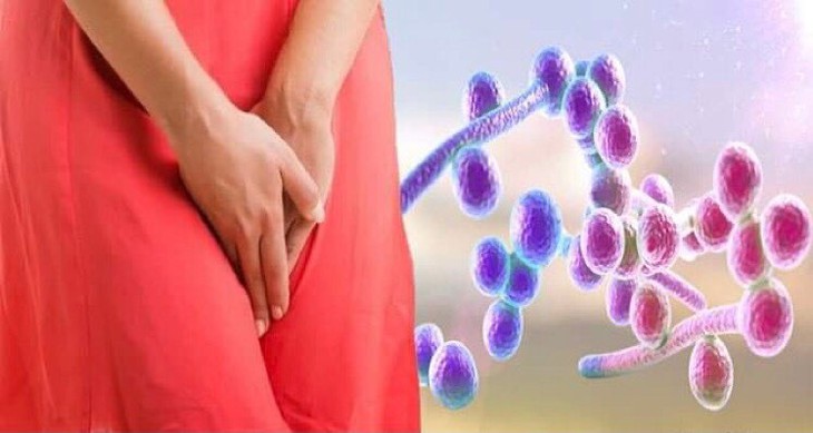 Các bệnh thường gặp do nấm Candida - Ảnh 5. Các bệnh thường gặp do nấm Candida - Ảnh 5.